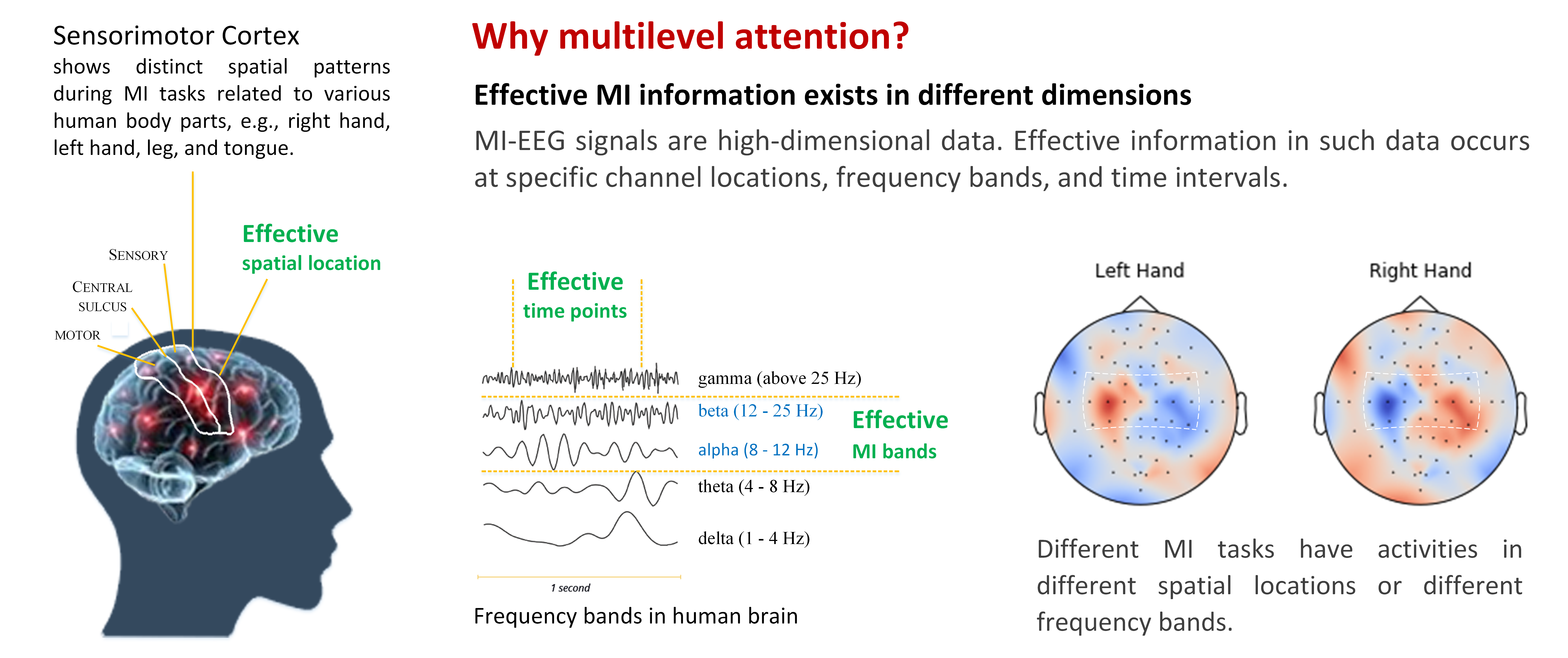 D-ATCNet Architecture